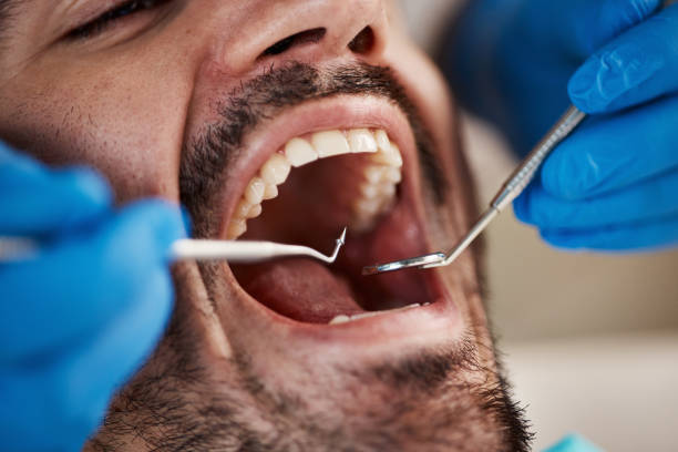 Best After-Hours Dental Trauma Care in Tuscumbia, AL